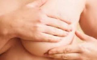 Фиброзно-кистозная мастопатия: лечение, симптомы, причины, профилактика