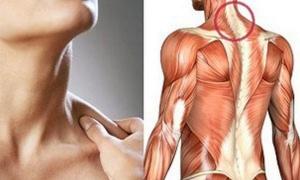Миозит мышц шеи: описание заболевания, симптоматика и методы лечения